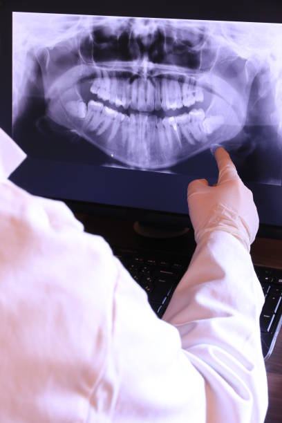 Best Emergency Wisdom Tooth Extraction in Madeira, OH