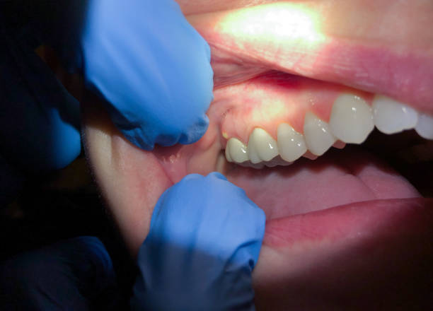 Best Emergency Dental Care for Sports Injuries in Madeira, OH